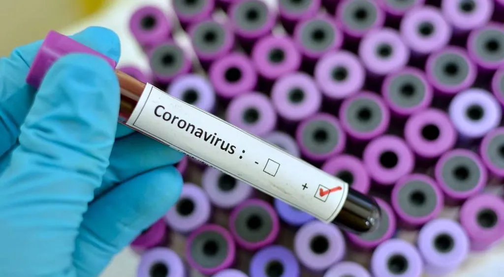 financialounge -  coronavirus GAM Tim Love